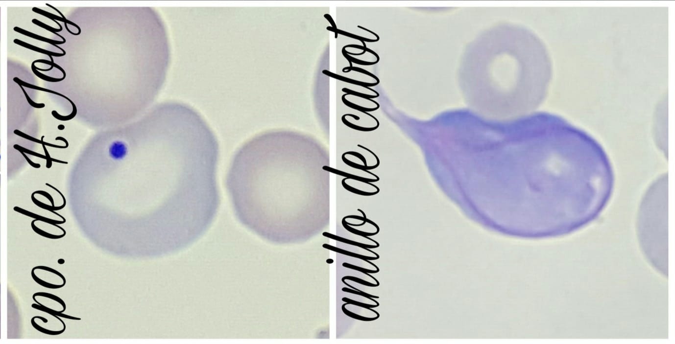 MOD3 ANEMIA MACROCITICA 25/03/2022 - 28/10/2022